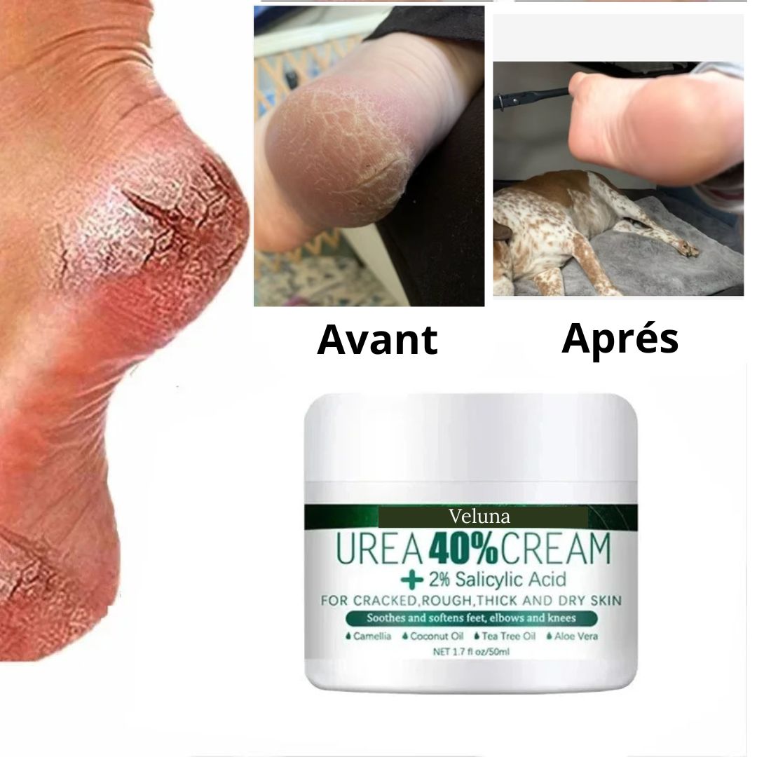 Crème réparatrice pieds- crevasses et callosités