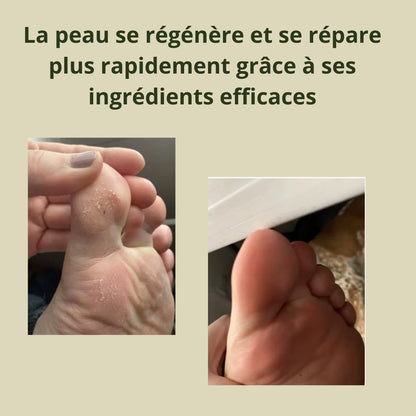 Crème réparatrice pieds- crevasses et callosités